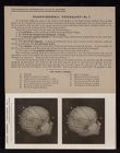 Cranio-Cerebral Topography - no. 1